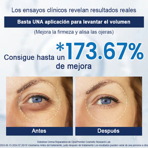 Crema reparadora para ojos a-Arbutin 2% + CRFs - 🎁Paquete de 2 (tratamiento completo)🎁