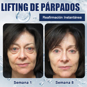 Crema reparadora para ojos a-Arbutin 2% + CRFs - 🎁Paquete de 2 (tratamiento completo)🎁