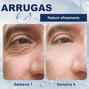 Crema reparadora para ojos a-Arbutin 2% + CRFs - 🎁Paquete de 2 (tratamiento completo)🎁