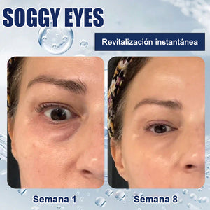 Crema reparadora para ojos a-Arbutin 2% + CRFs - 🎁Paquete de 2 (tratamiento completo)🎁