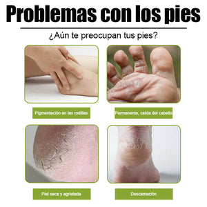 Spray exfoliante para pies Mejora la piel áspera Apto para todo el cuerpo