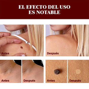 Esencia para eliminar manchas y lunares - Compra 1 y recibe 1 gratis (2 piezas)