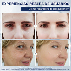 Crema reparadora para ojos a-Arbutin 2% + CRFs - 🎁Paquete de 2 (tratamiento completo)🎁