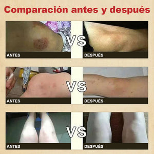 Parche para el dolor específico de la sinovitis de rodilla